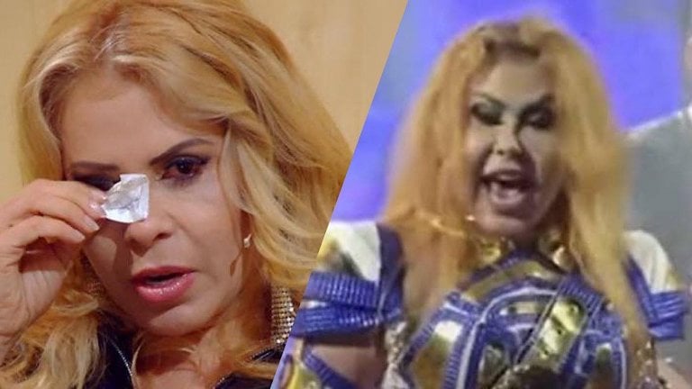 Joelma posta foto após preocupar fãs ao surgir com o rosto completamente inchado em show: “Seja forte”