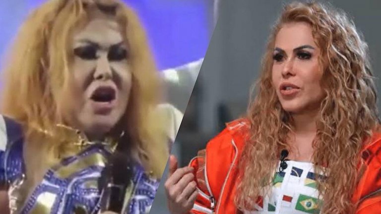 Joelma tem quadro de saúde divulgado e motivo do inchaço explicado: “Efeito da combinação”