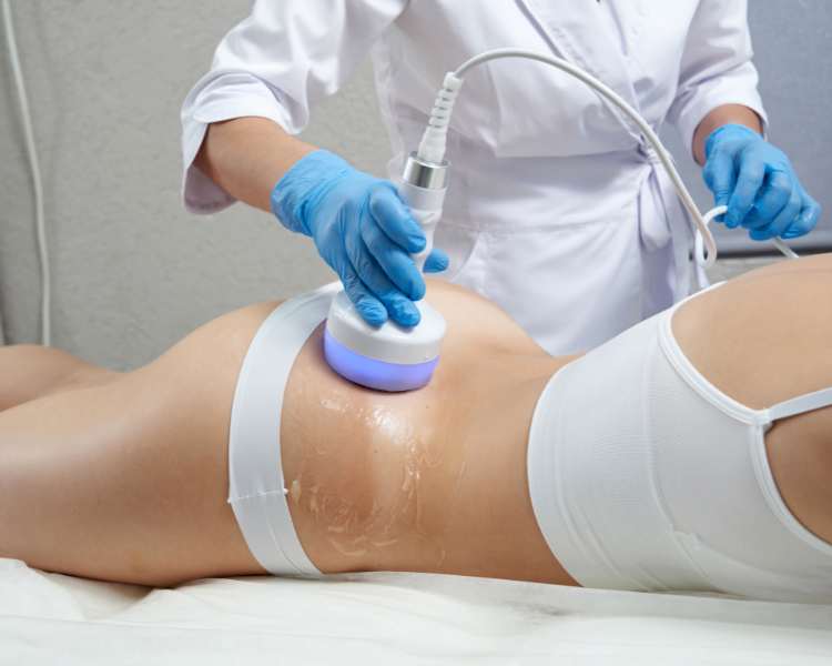 Mulher fazendo tratamento estético com ultrassom microfocado corporal para tratar celulites