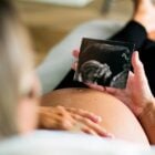 Mulher de pele clara deitada com a mão na barriga grávida, calça preta e segurando foto de ultrassom