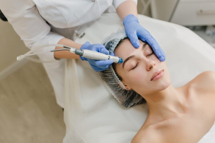 Peeling: o que é, como se faz e benefícios do tratamento facial