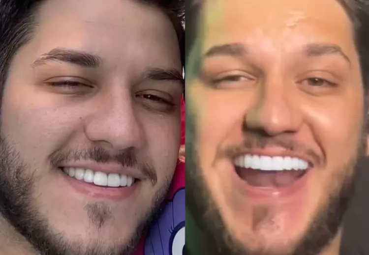 Antes x depois de Lucca