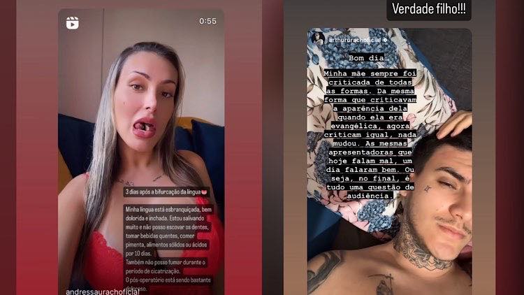 Após cirurgias, Andressa Urach afirma que está sentindo dor e desconforto no pós-operatório da língua.