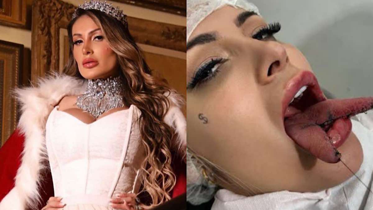 Após cirurgias, Andressa Urach afirma que está sentindo dor e desconforto no pós-operatório da língua.