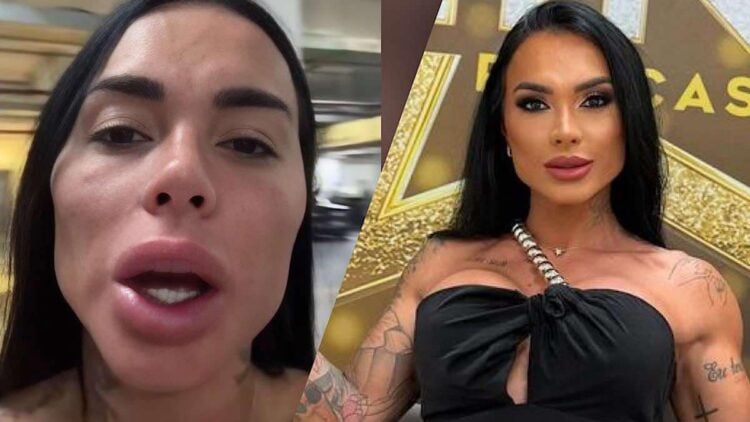 Kamila Simioni deixa fãs impactados com imagem após harmonização facial.