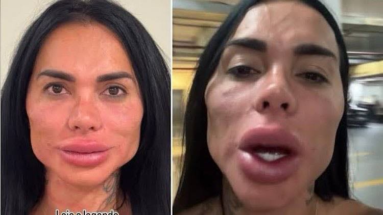 Kamila Simioni deixa fãs impactados com imagem após harmonização facial.